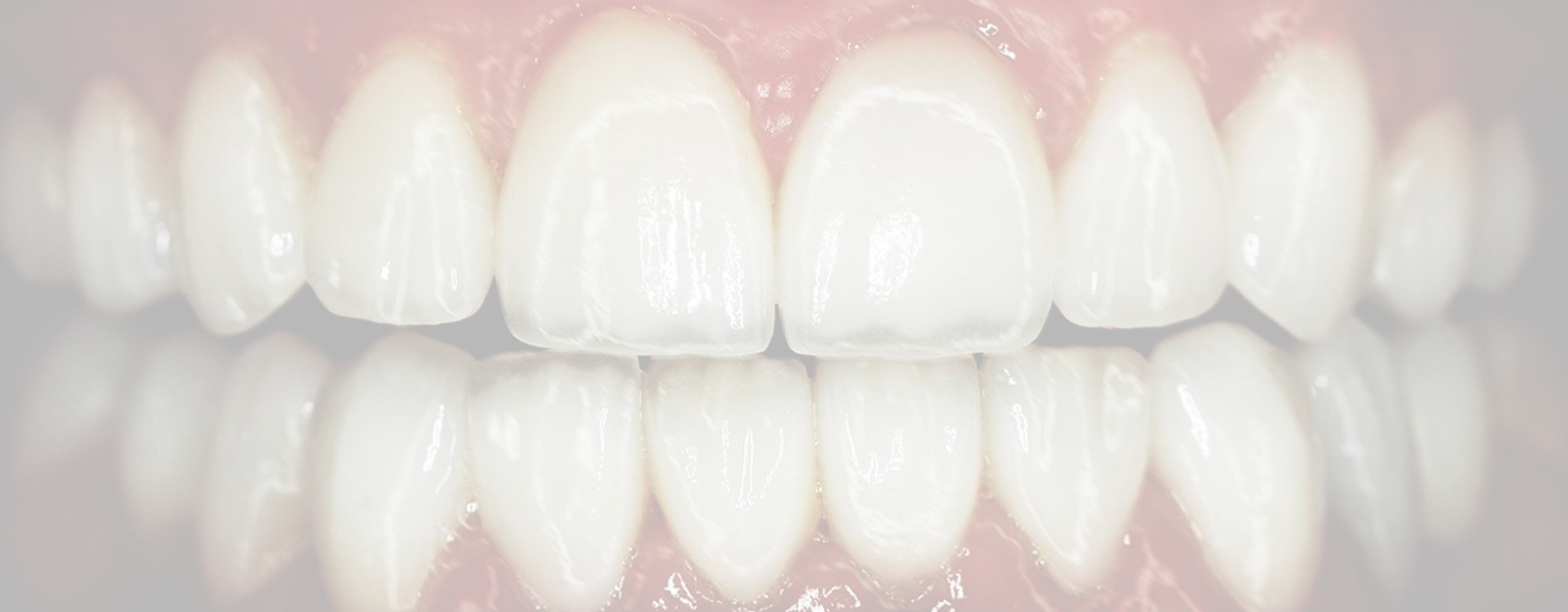 Don't like teeth? Fix with cosmetic work,