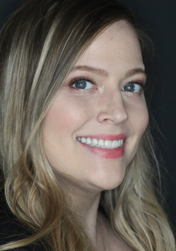 patient with dental implants
