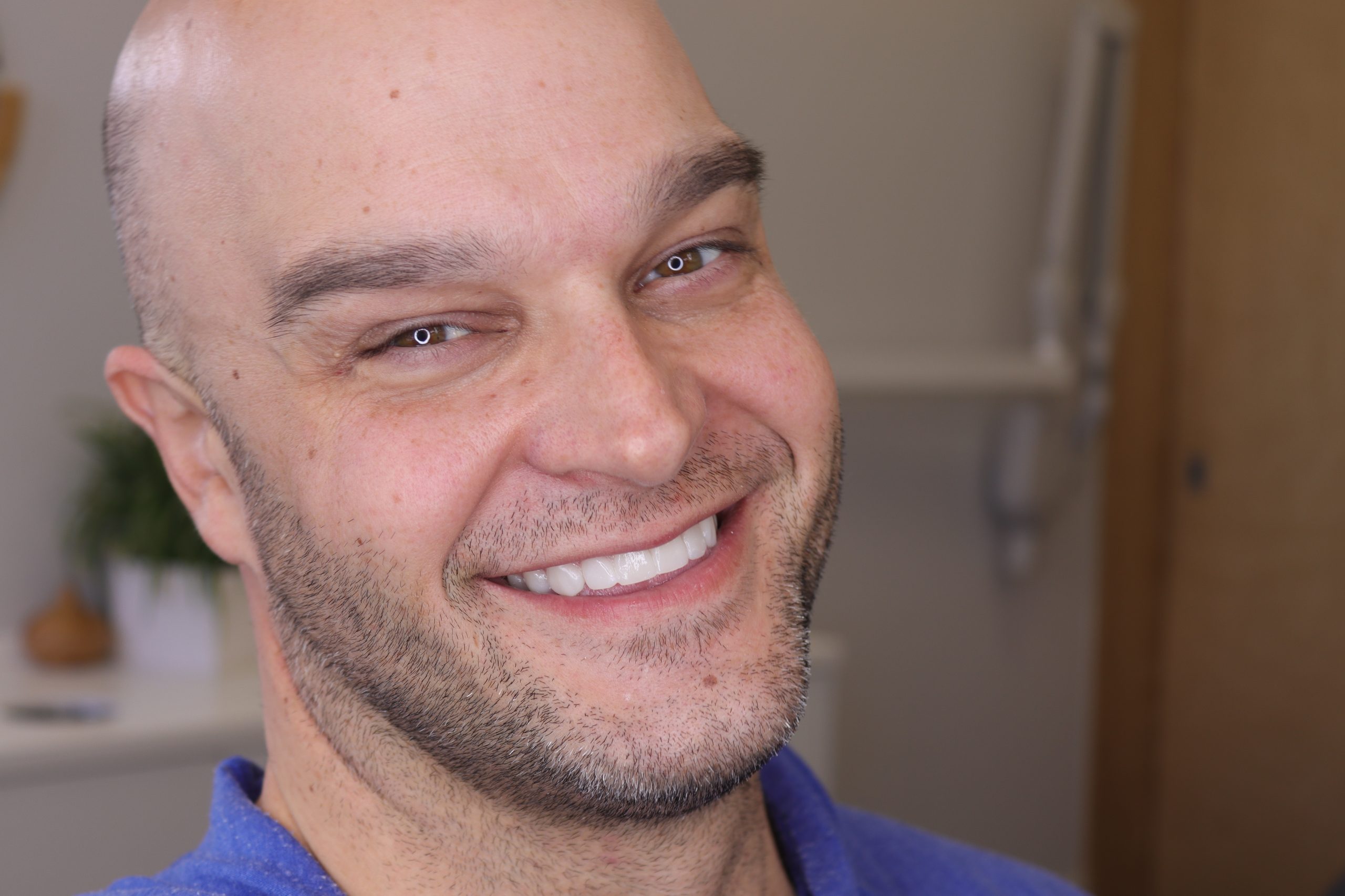 Man with Digital Smile Design Try-In