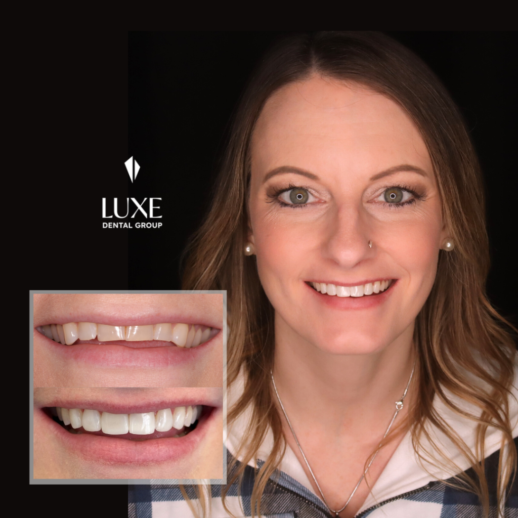 Reverse Smile Curve Transformation