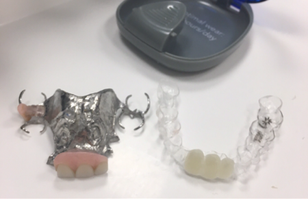 invisalign partial